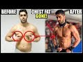 How To Reduce CHEST FAT In 7 Days - 100% WORKS!!
