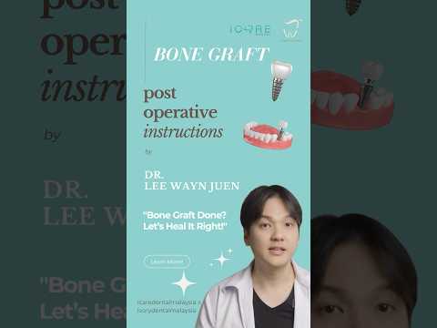 Bone Graft Aftercare Instructions | What You Must Know