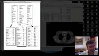 Smart Album no OsiriX