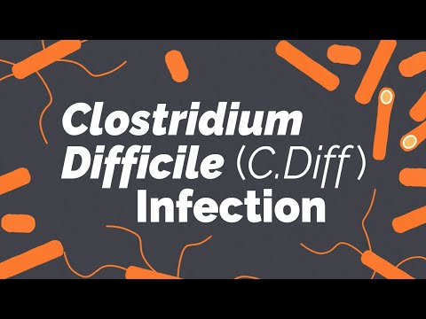 Clostridium difficile fogyás)