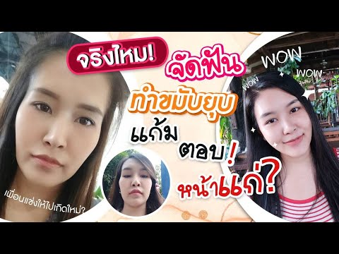 จัดฟัน ทำขมับยุบ แก้มตอบ โหนกชัด หน้าแก่ จริงมั้ย แล้วถ้าถอดเครื่องมือแล้วจะดีขึ้นมั้ย หามาให้แล้ว