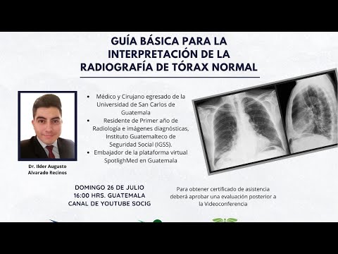 GUÍA BÁSICA PARA LA INTERPRETACIÓN DE LA RADIOGRAFÍA DE TÓRAX NORMAL