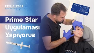 Prime Star Uygulaması Yapıyoruz.