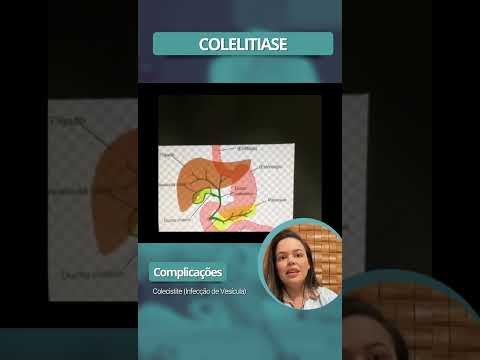 Cirurgia Robótica — Resultados — Dra. Rita Rocha