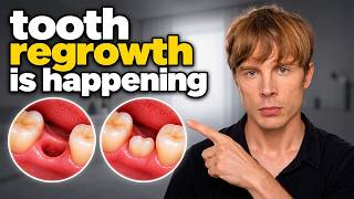 The New Tooth Regrowth Breakthrough You Need to Know About