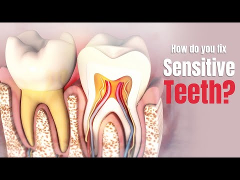 How do you fix sensitive teeth? Causes, Treatment Options, and Prevention Tips - 3D Guide