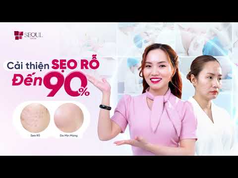 Cải Thiện Sẹo Rỗ Đến 90% Khi Đến Với Seoul Center