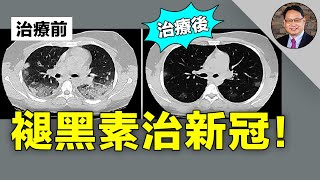 [問題] 請益，能幫肺部纖維化的父親緩解症狀的醫