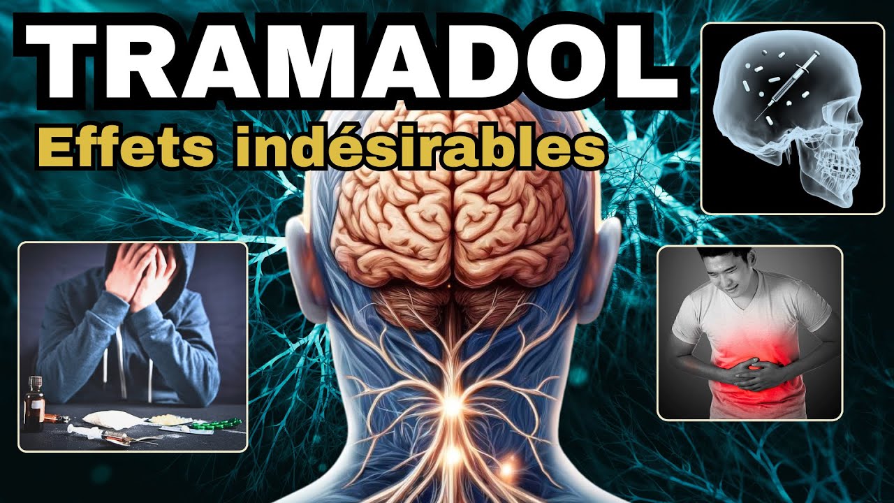 TRAMADOL et ses EFFETS INDESIRABLES à connaître