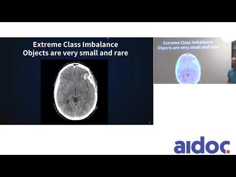 Applying the Cutting Edge of Object Detection to Medical Imaging