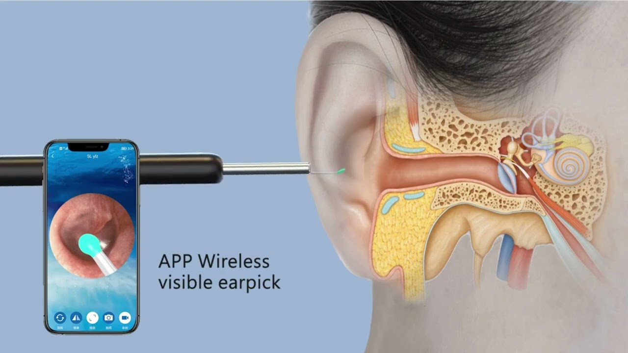 EarClean Pro™ - Precision Ear Cleaning with 1080p HD Camera