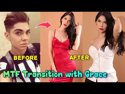 Her MTF Transition Will Inspire You to Be Yourself | Male to Female Transition | MTF Transition 