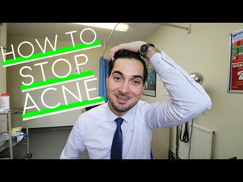 How To Get Rid of Acne Best Spot Treatment How To Use Benzoyl Peroxide Prevent Acne 2018