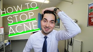 How To Get Rid of Acne | Best Spot Treatment | How To Use Benzoyl Peroxide | Prevent Acne