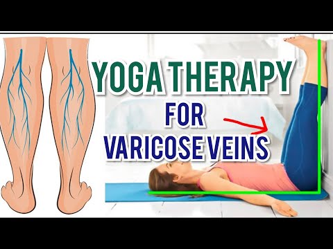 yoga de picior cu varicoza