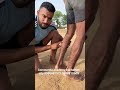 यह होती है Varicose Vein S Medical Problems Commandoacademy