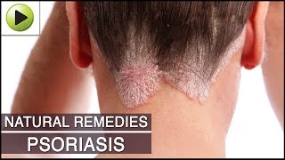 Skin Care - Psoriasis - Natural Ayurvedic Home Remedies