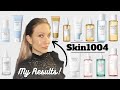 Skin1004 Review What S The Difference Between The Lines