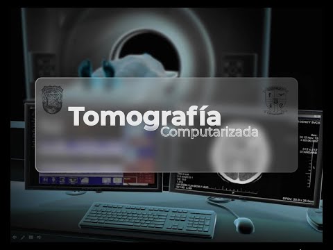 TOMOGRAFIA COMPUTARIZADA VERANO 2021