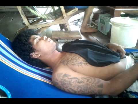 สาเหตุโรคสะเก็ดเงินของโรคและการรักษา Nummulyarnaya กลากเป็นโรคติดต่อ