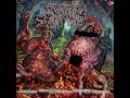 Epicardiectomy - Vaginal Colony Full Of Vermin ...