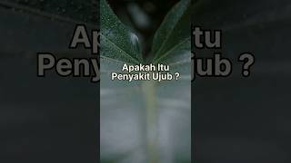 Download lagu Apakah itu penyakit Ujub ?#shortsfeed #youtubeshorts #islam #muslim mp3 Download lagu Apakah itu penyakit Ujub ?#shortsfeed #youtubeshorts #islam #muslim mp3