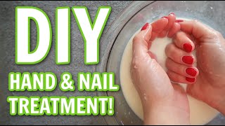 Treat DRY Hands & Nails - 2 INGREDIENT SOAK!