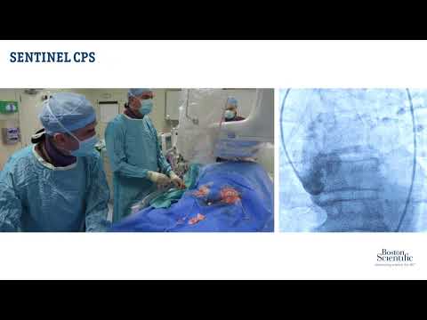 SENTINEL™ CPS: Live Case Deployment