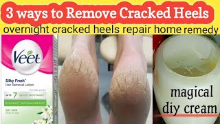 How to Remove Cracked Heels Overnight - 3 Simple Methods | Diy cracked heels Cream