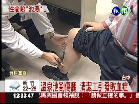 傷口泡含菌溫泉水 引發敗血症