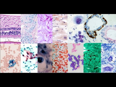 Different kinds of histology stains