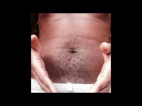 Folcast -  Vai Via ( BLCKEBY Remix)