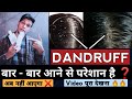 How To Remove Dandruff From Scalp Dandruff Kaise Hataye Dandruff Solution Hindi Men And Women