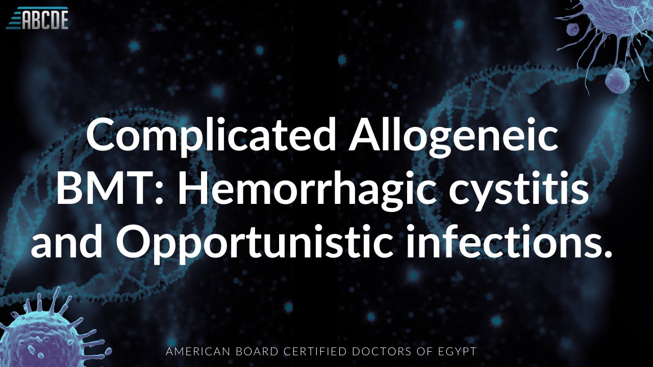 Philadelphia+ ALL & HSCT: Case-Based Discussion on Complications, MRD & Hemorrhagic Cystitis