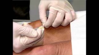Knee Injection - Empire Medical Training