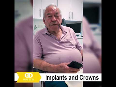 Los Algodones Smile Restored: Affordable Implants & Crowns Package