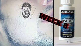 Minoxidil Beard | Week 8 | The Experiment |  #FacialFuzzFridays