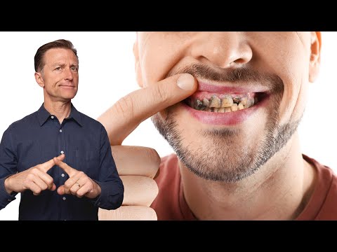 Hidden Dangers of Soy How Does it Affect Your Body – Dr Berg