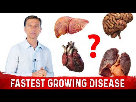 Do You Have Copper Toxicity