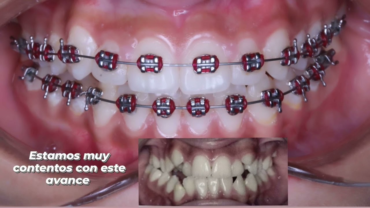 José Luis Pérez Vázquez-9