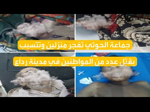 جماعة الحوثي تفجر منزلين وتتسبب بقتل عدد من المواطنين في مدينة رداع