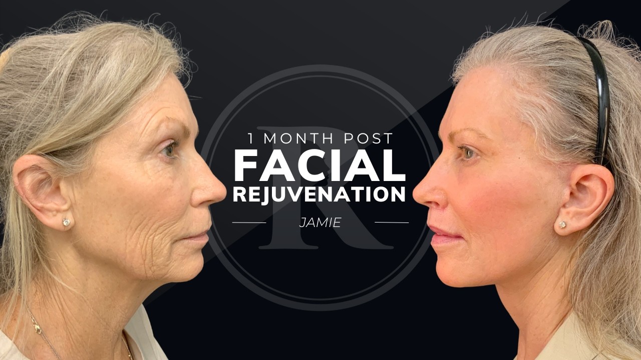 Robb Facial Plastic Surgery