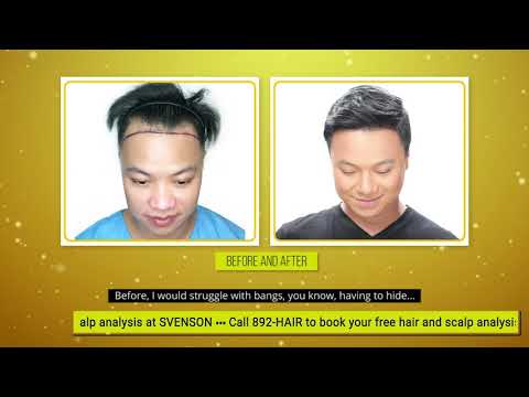 Regain a full hairline. Watch Ricci Chan’s story.