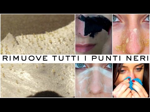Come ci sono parassiti dopo trattamento Libro di sogno di uovo di parassiti in