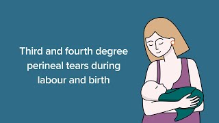 Third and fourth degree tears during labour and birth - a video for consumers