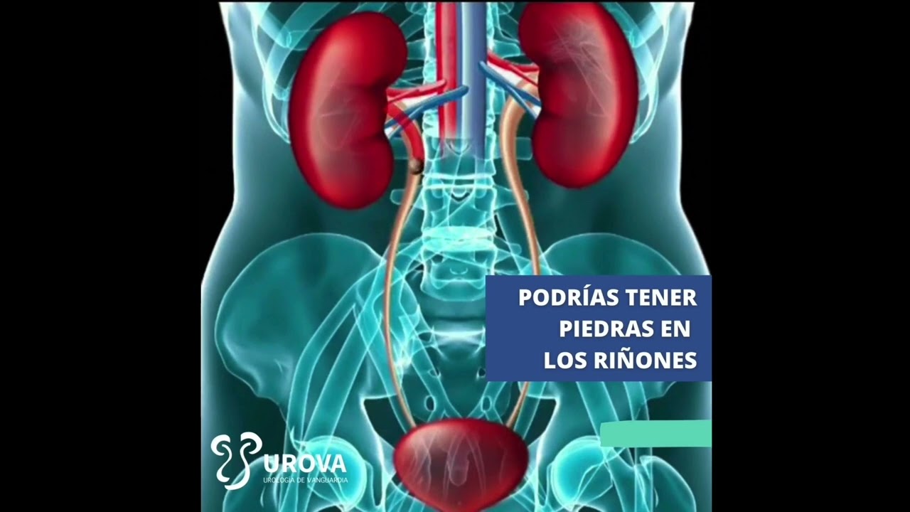 Carlos Enrique Caballero Hernandez-10