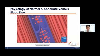 Discover the Truth About Varicose Veins and How to Keep Your Legs Healthy