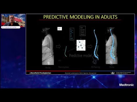Lecture: UNiD™ ASI Technology for use in Adult Spinal Deformity
