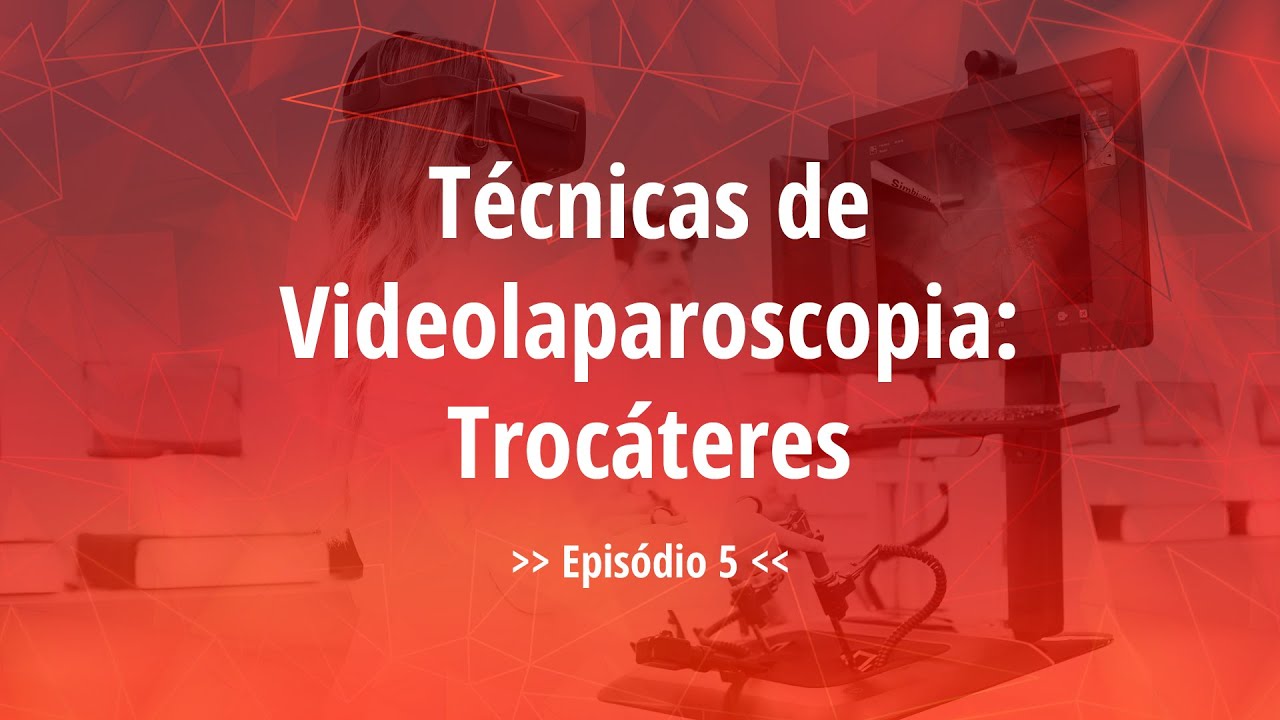 Técnicas de Videolaparoscopia: Trocáteres ep.5 - Videocirurgia