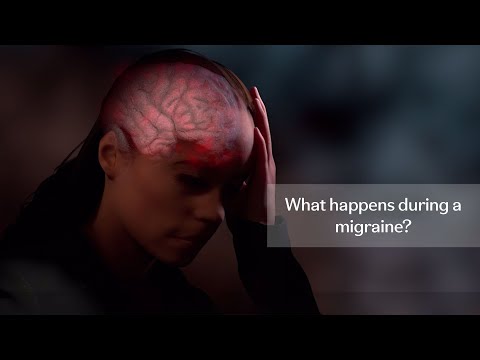 Stages of a migraine: What happens during a migraine?